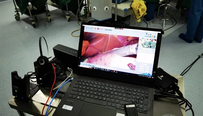 Le cucitrici chirurgiche CAK brillano in sei interventi chirurgici dal vivo in tutta la cina